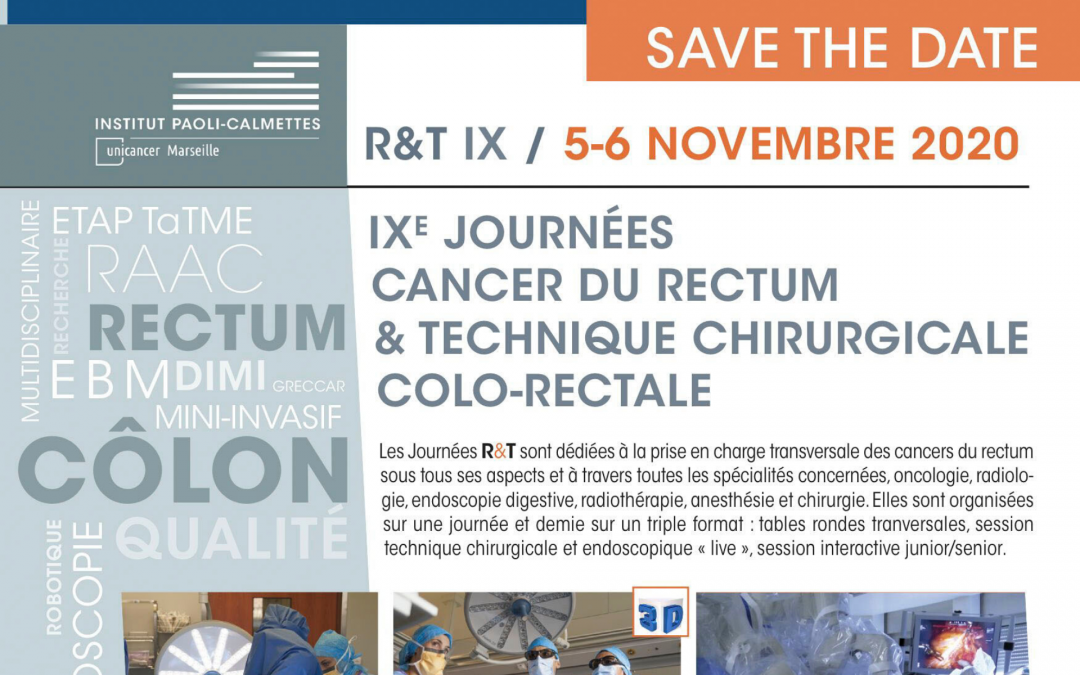 5-6 novembre 2020 : IXe Journées cancer du rectum & technique chirurgicale colo-rectale [100% distanciel]