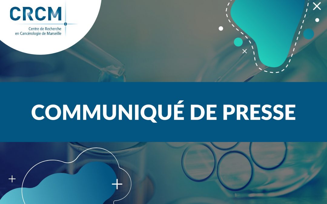 Les premiers résultats de l’essai clinique CeGAL : une approche prometteuse dans la leucémie aiguë myéloïde (LAM)