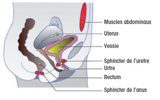 Sonde urinaire : pose et effets secondaires