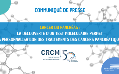 Cancer du pancréas : La découverte d’un test moléculaire permet la personnalisation des traitements des cancers pancréatiques