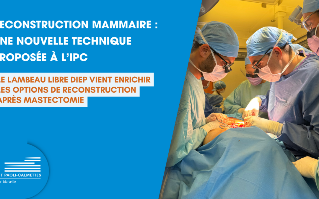 Reconstruction mammaire après mastectomie : l’IPC développe la technique du lambeau libre DIEP